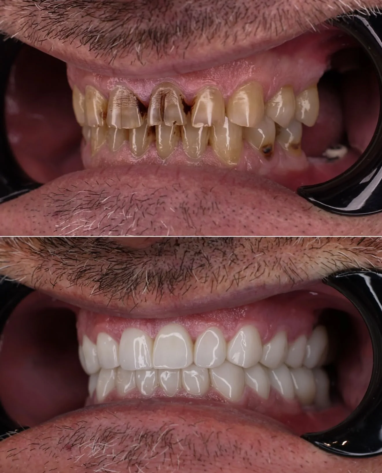 Prima e dopo di un trattamento dentale Ruggeri Medical